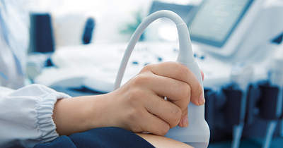 التصوير بالموجات فوق الصوتية